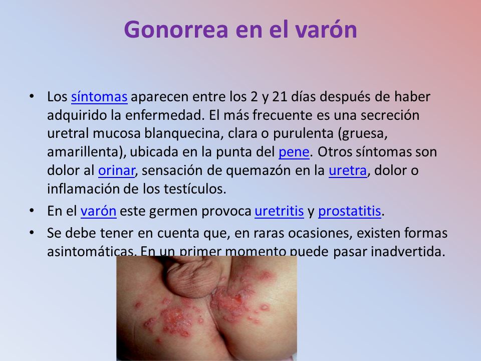 uretritis es gonorrea uretritis es gonorrea